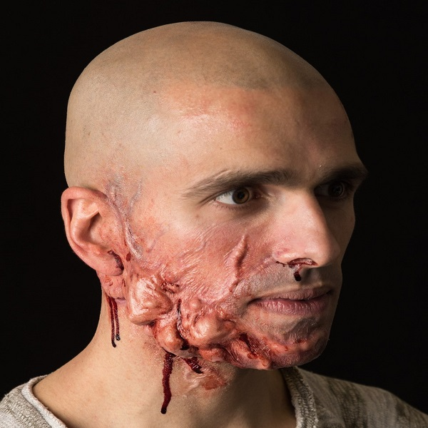 Infections & Decay
