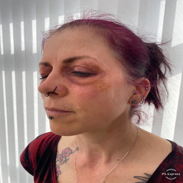 Subtle Bruised Eye (Left) Silicone Prosthetic