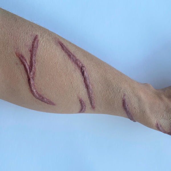 Keloid Scar Set Silicone Prosthetics