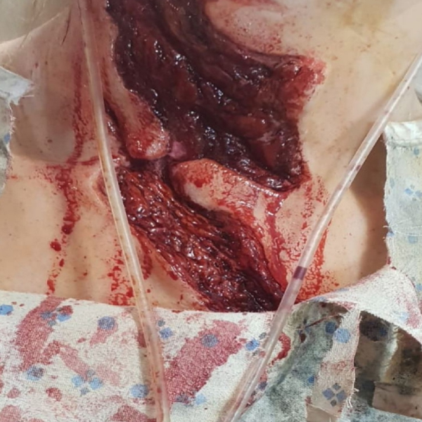 Large Neck Wound / Trauma / Laceration / Latex Free / Makeup - MonsterFX